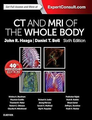 CTI and MRI of the whole body- John R. Haaga.