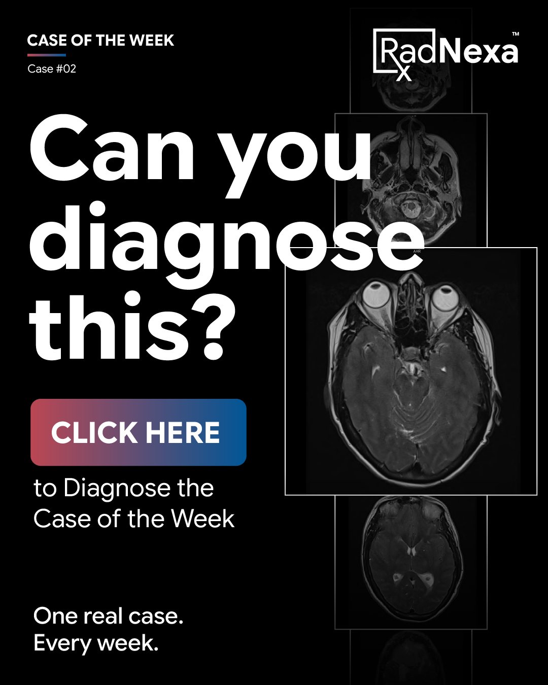 popup-image